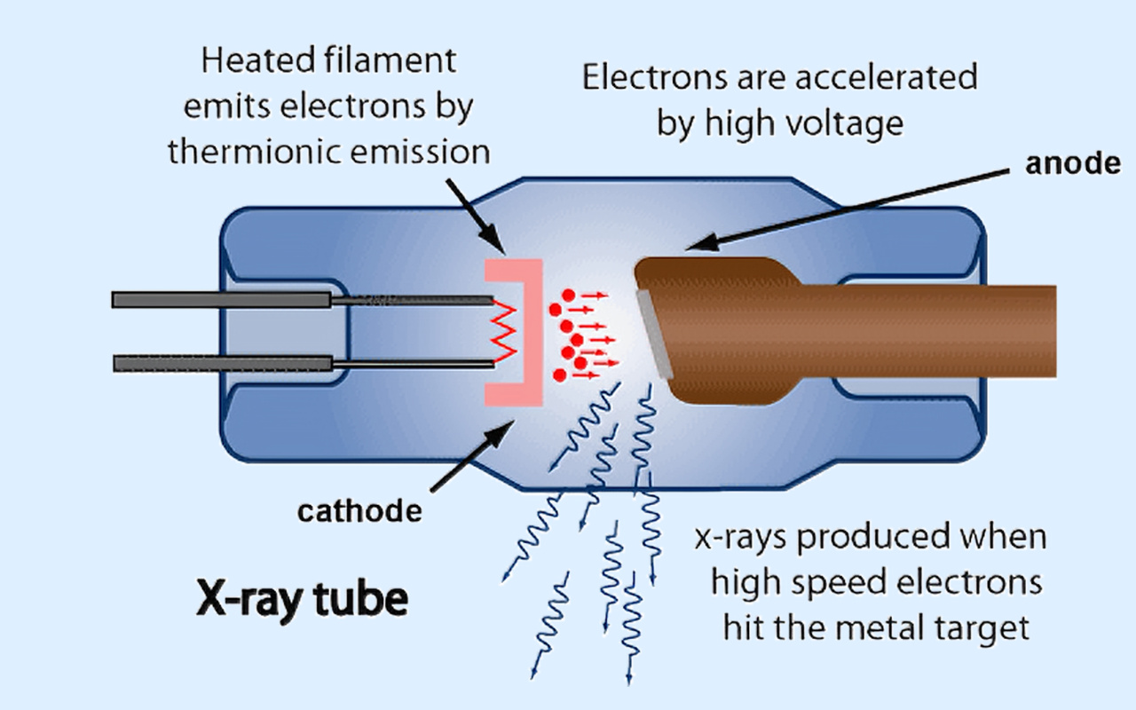 2. What X-ray Technology Actually Does 2. X 線技術が実際に行うこと
